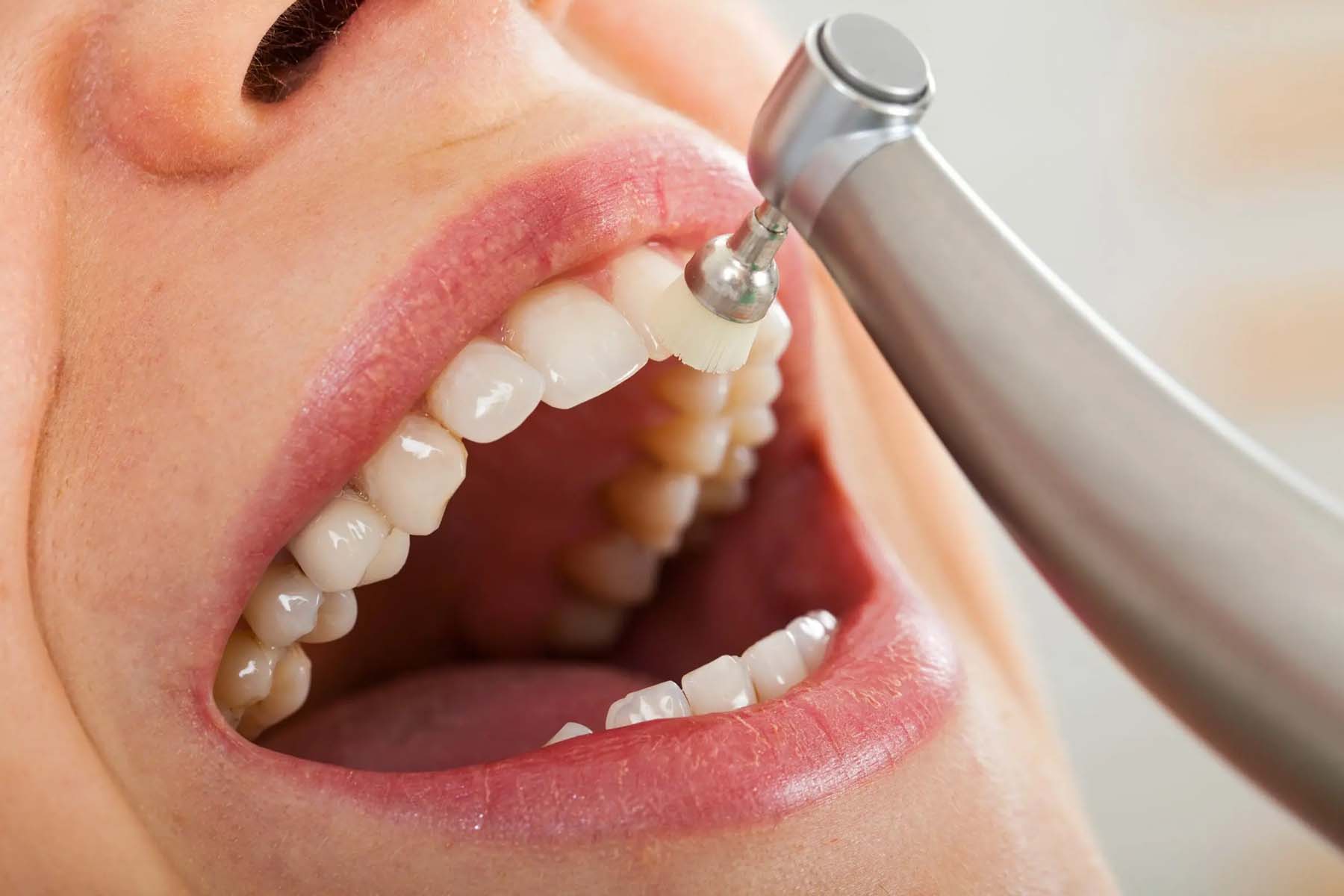 The Surprising Health Benefits of Regular Dental Cleanings